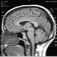 brains